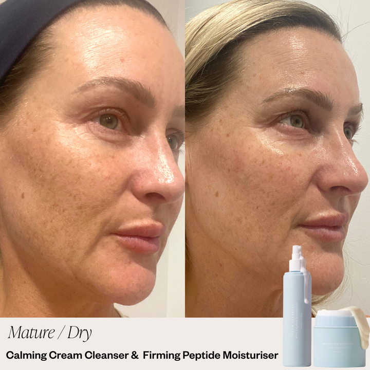 Skin before and after using 2 Step Skincare System showing clearer complexion