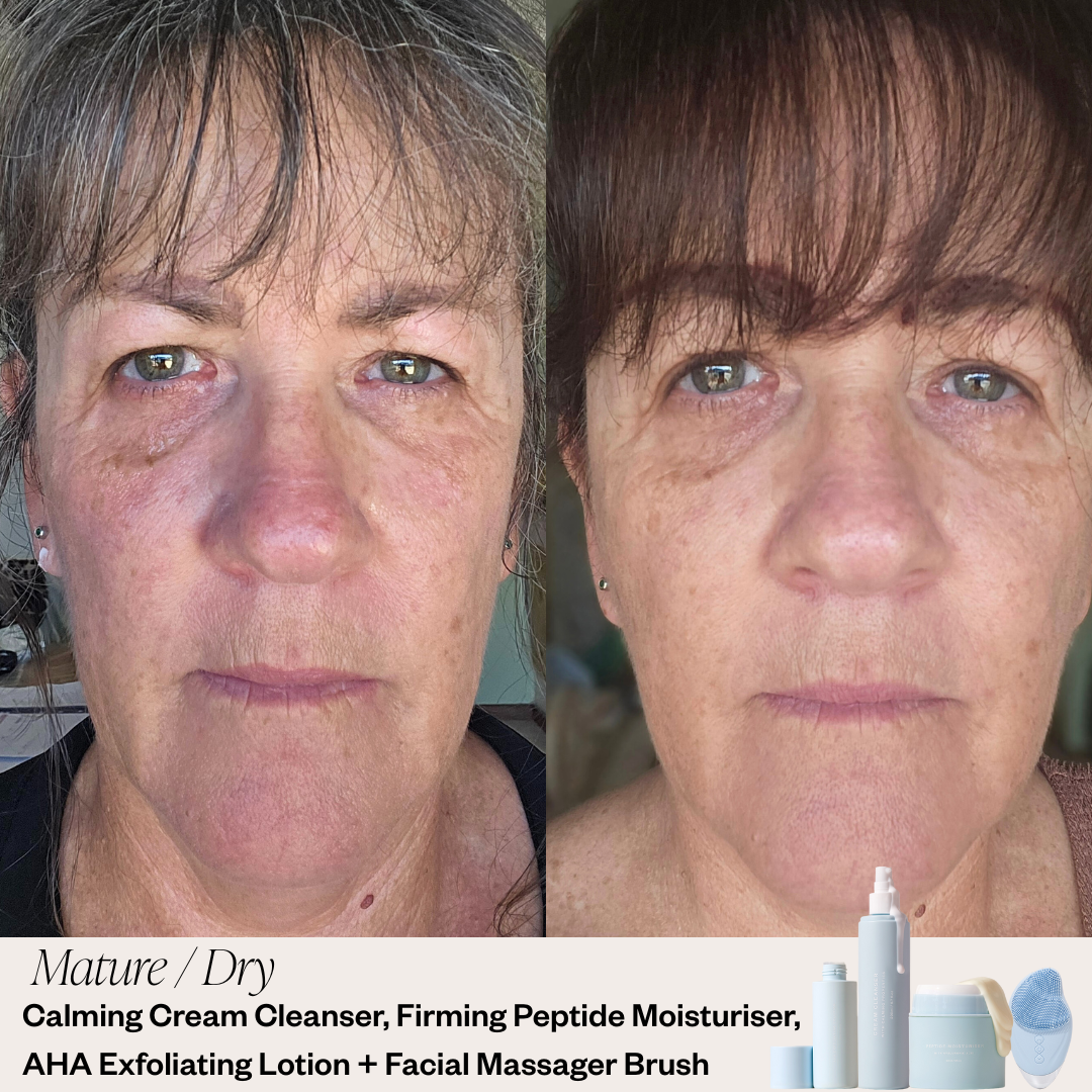 Skin before and after results