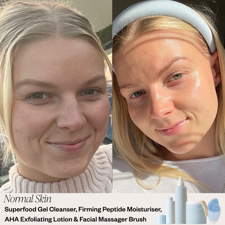 Skin before and after results