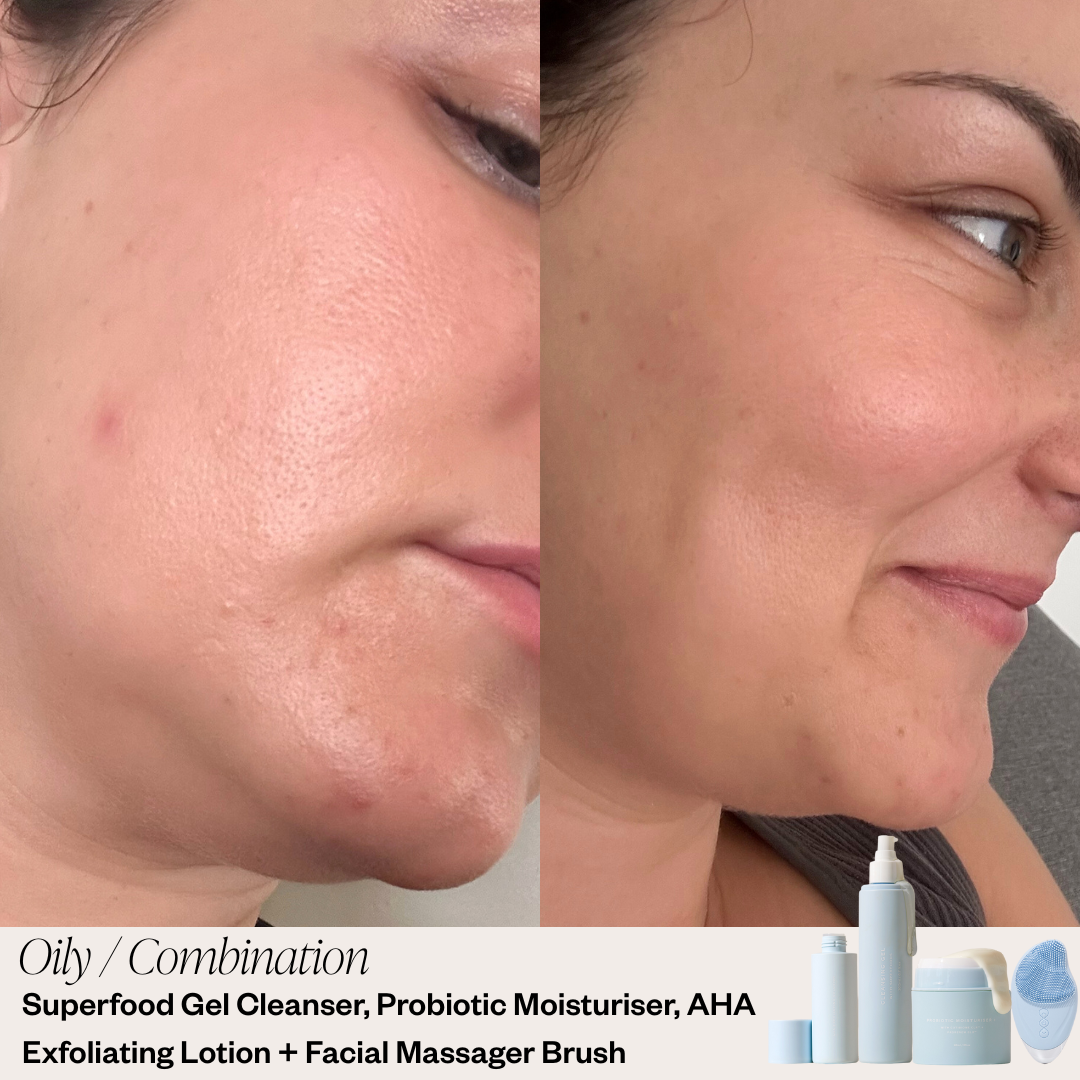 Skin before and after photo
