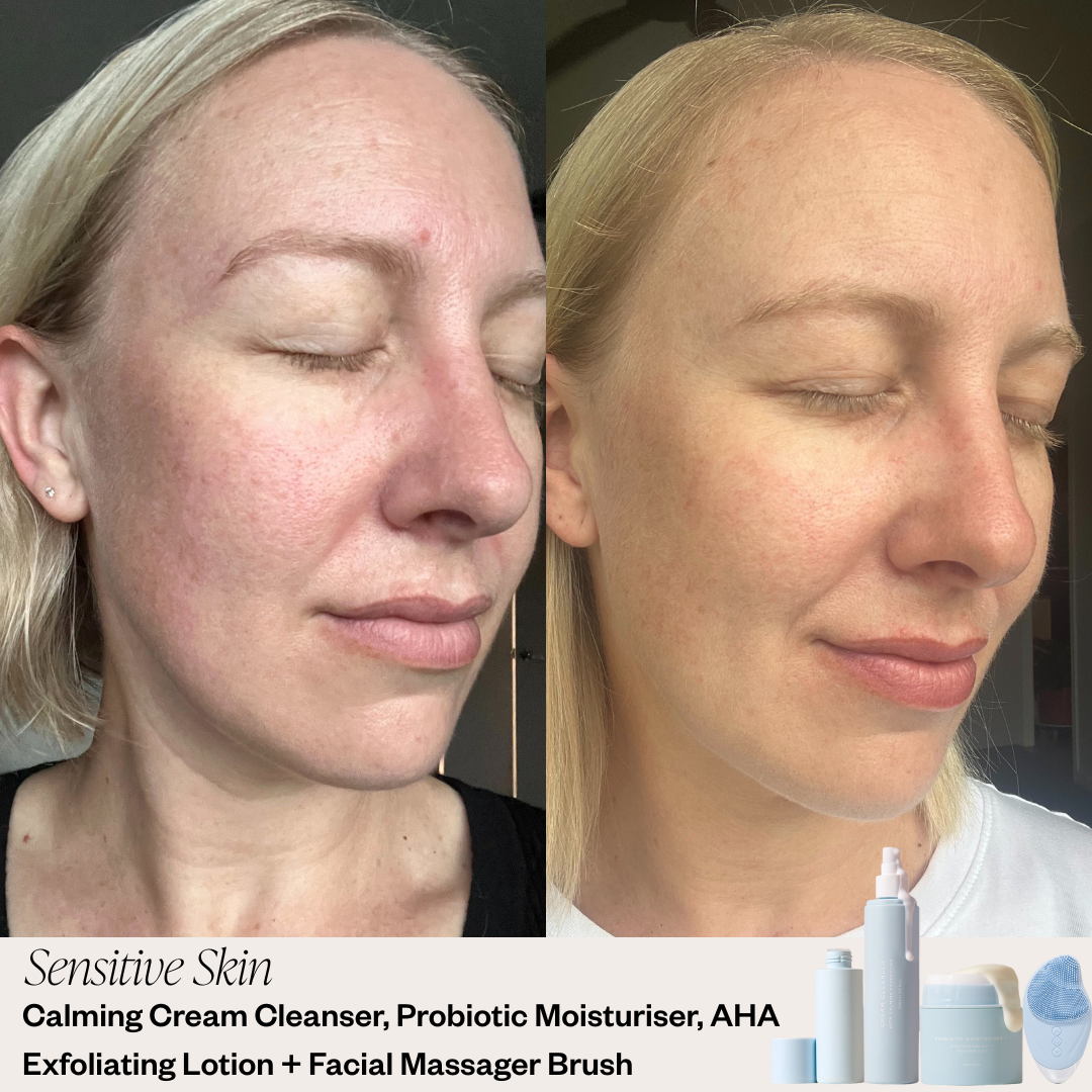 Skin before and after results