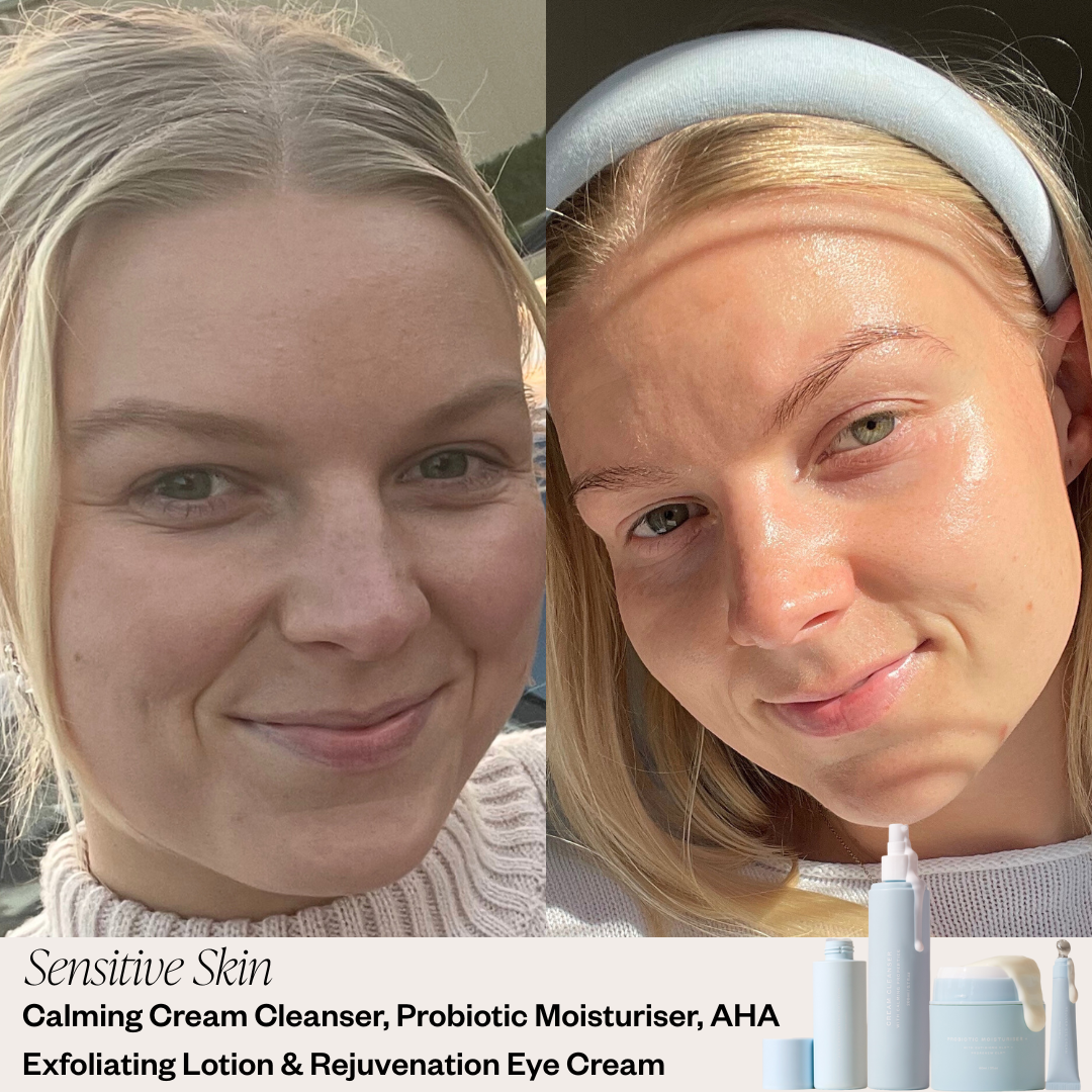 Skin before and after results
