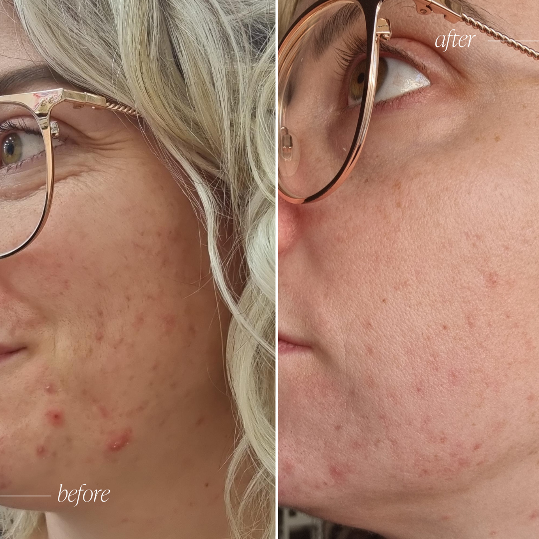 Probiotic Moisturiser +