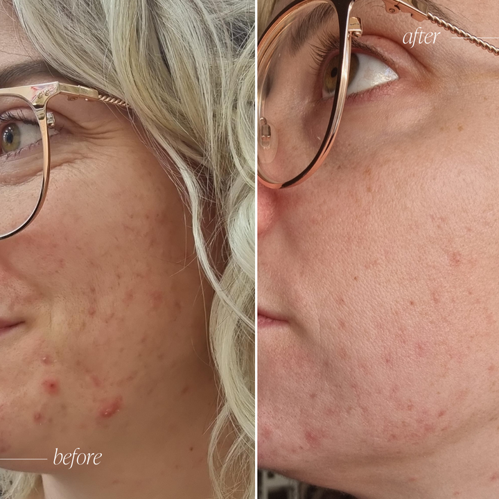 Probiotic Moisturiser +
