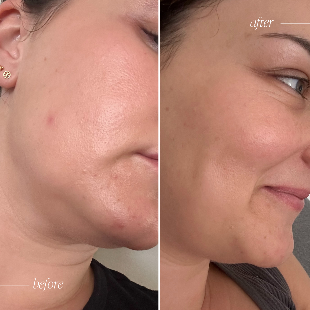 Probiotic Moisturiser +