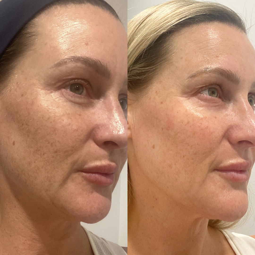 Skincare Starter bundle - Trial