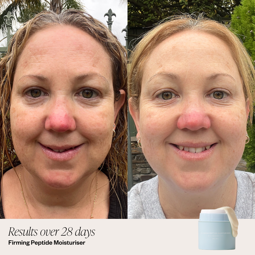 Viral Firming Peptide Moisturiser results in 28 Days