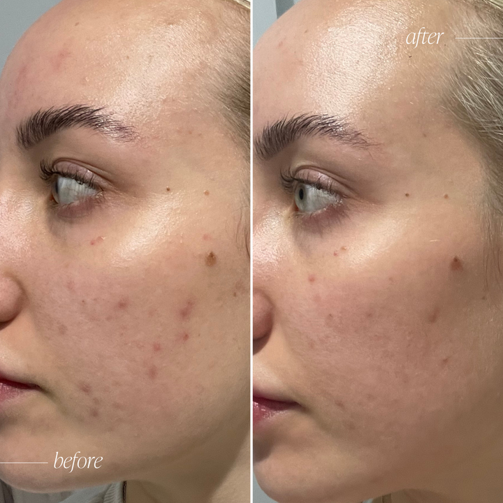 Probiotic Moisturiser + Trial Size