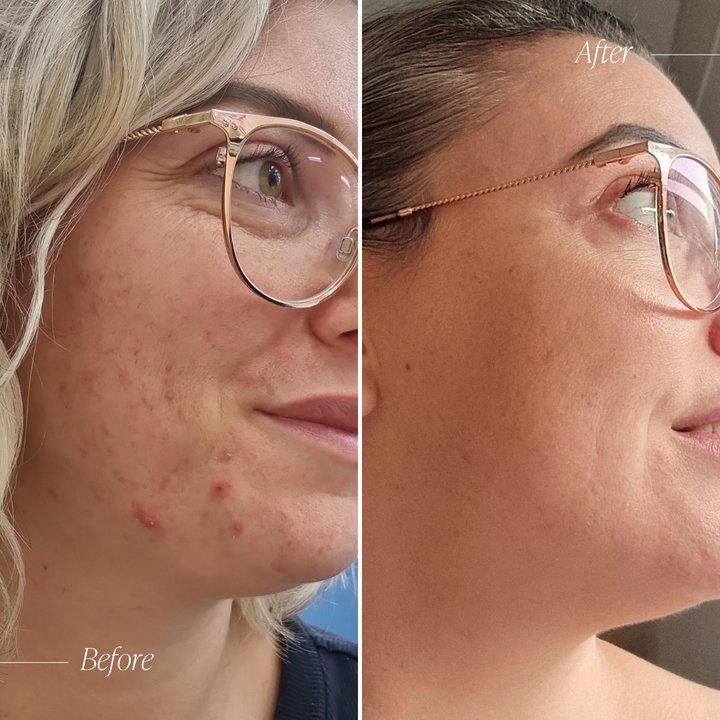 Targeted Skincare Trial System
