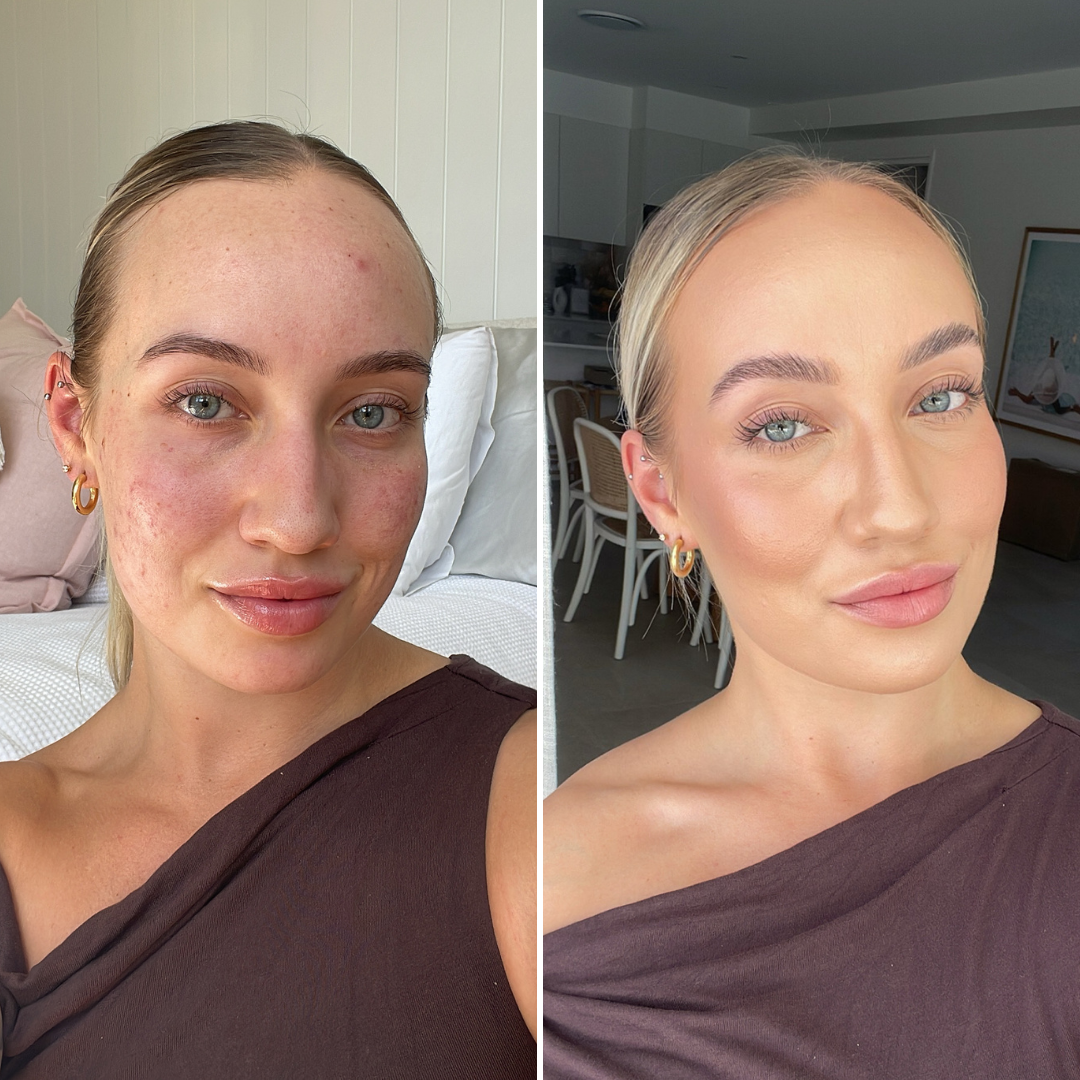2 Step Pro Finish Liquid Foundation Makeup Bundle - Acne-Prone/Oily/Sensitive Skin