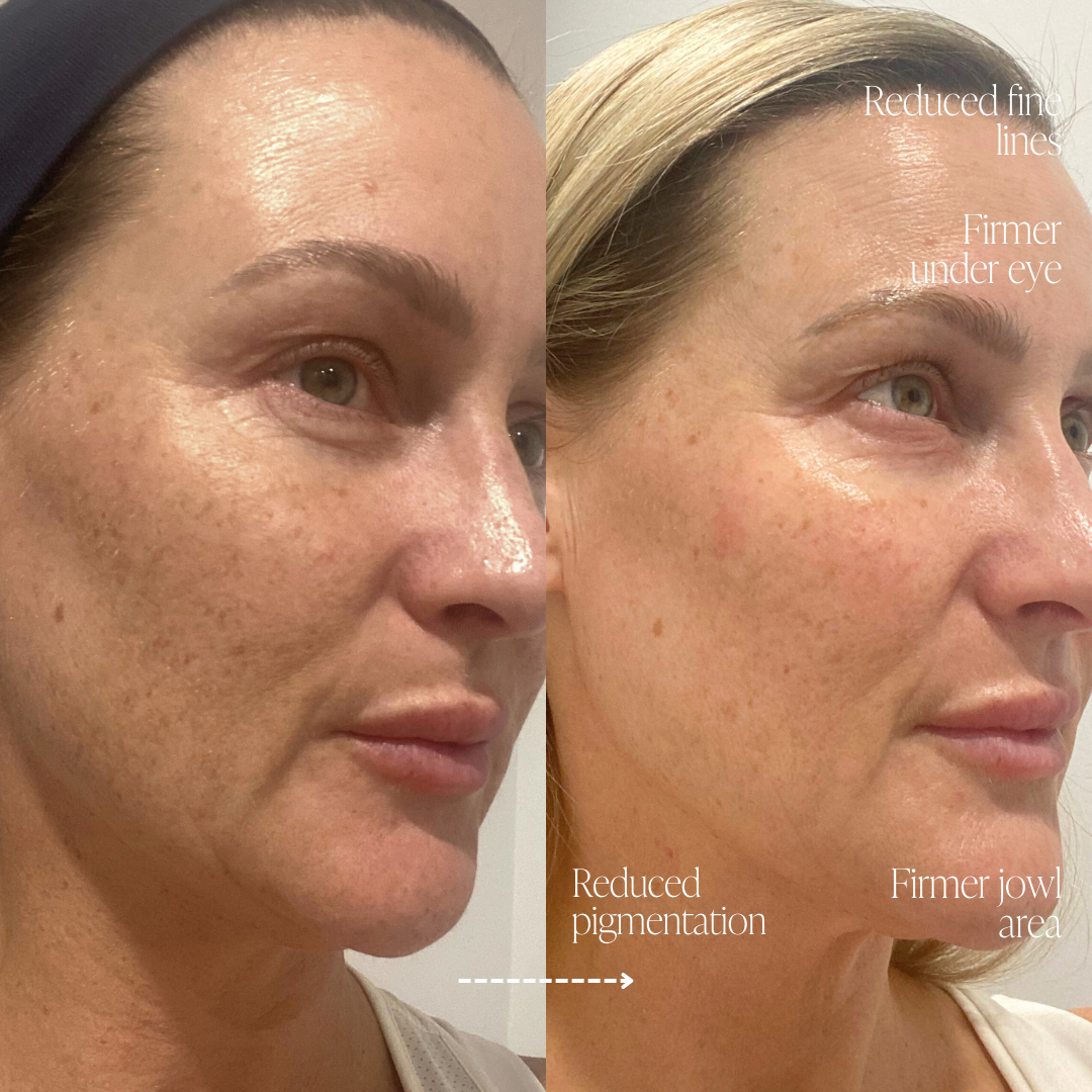 Anti-Ager Skin Trial Bundle