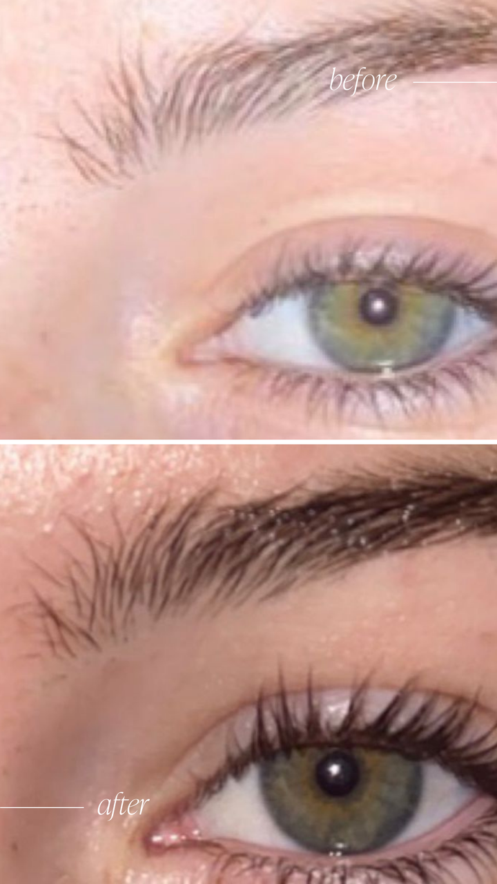 Lash & Brow Growth Serum