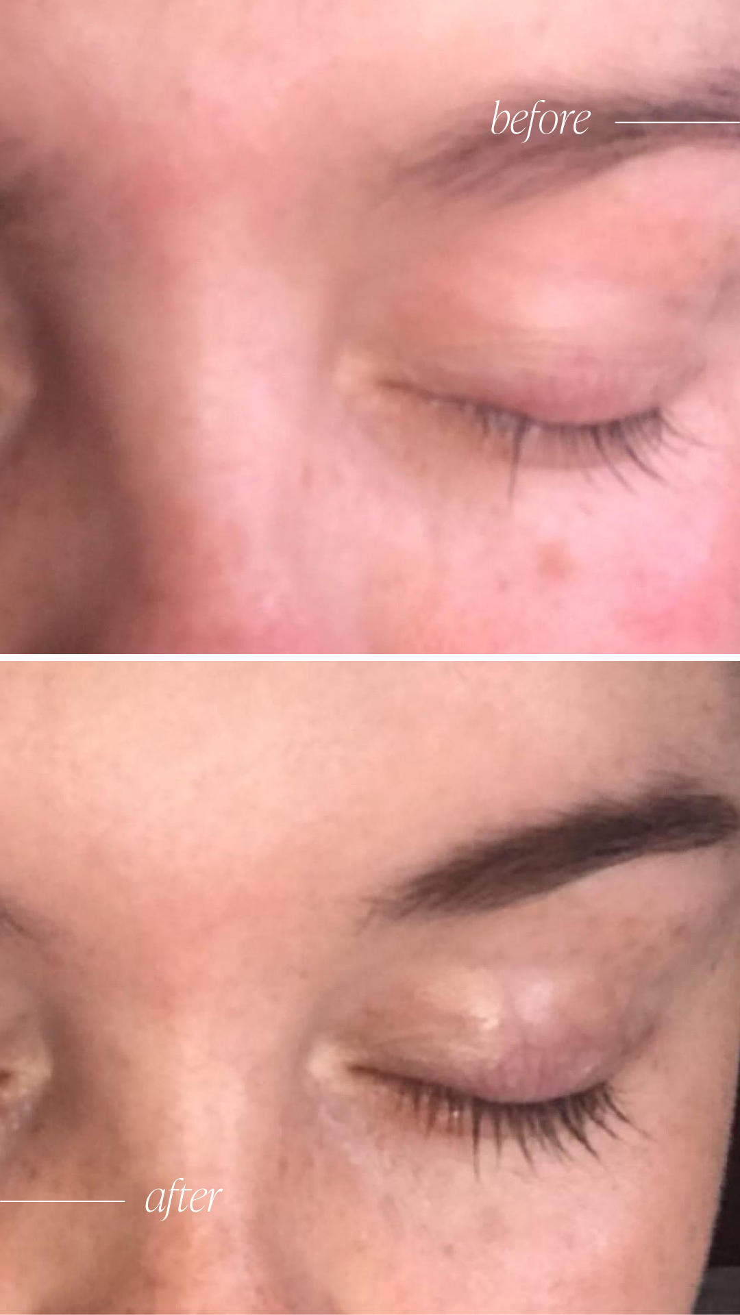 Lash & Brow Growth Serum