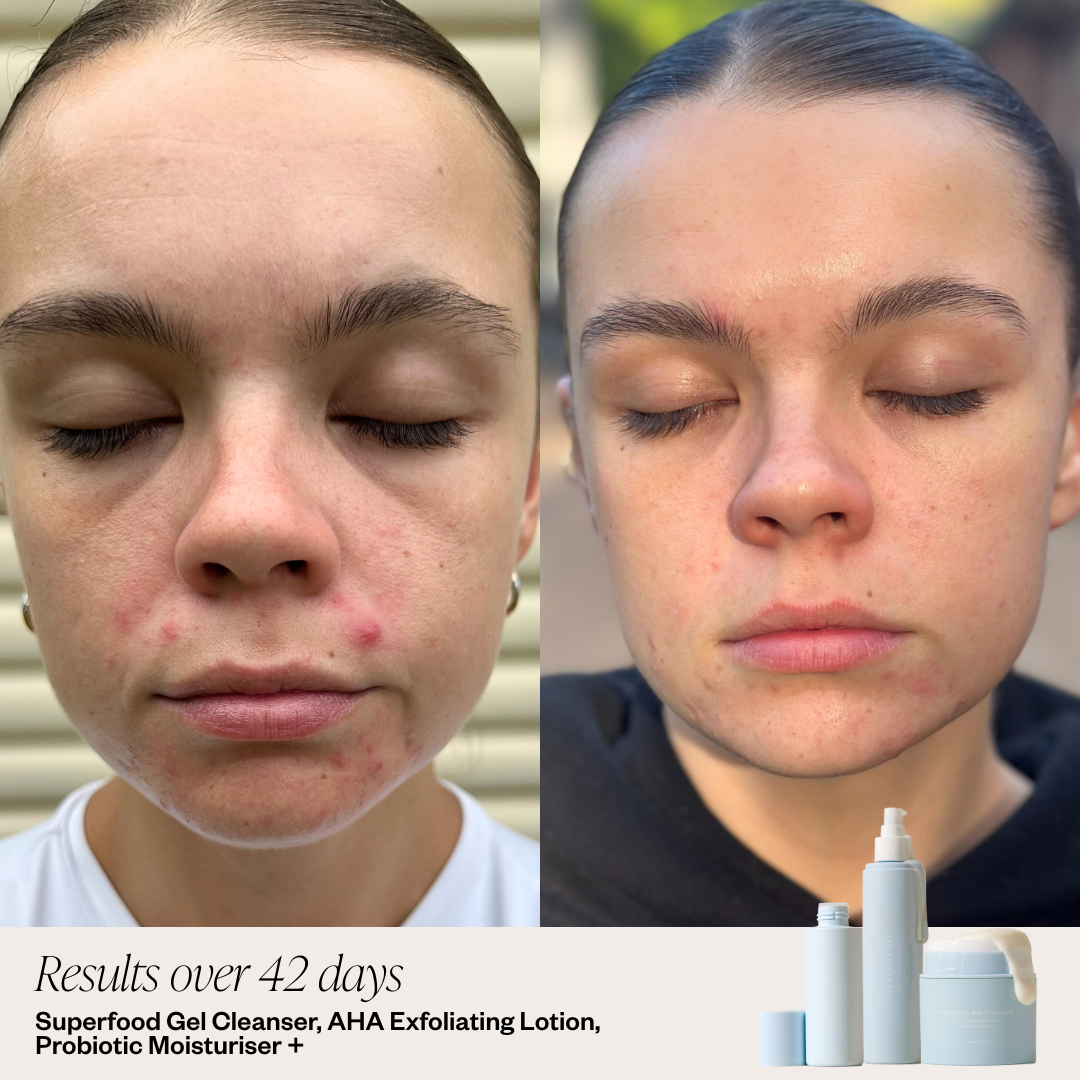 Superfood Gel Cleanser