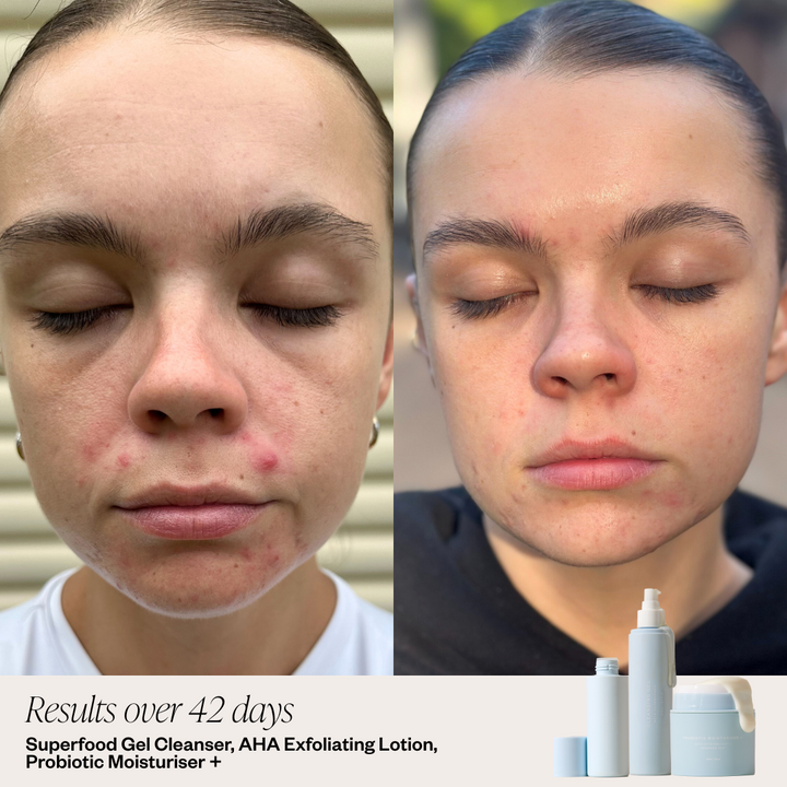 Superfood Gel Cleanser