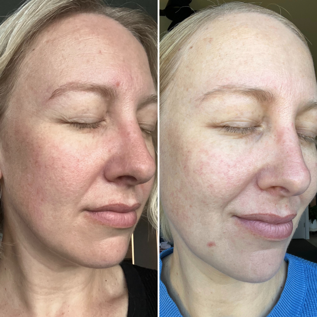 Viral Firming Peptide Moisturiser results in 28 days