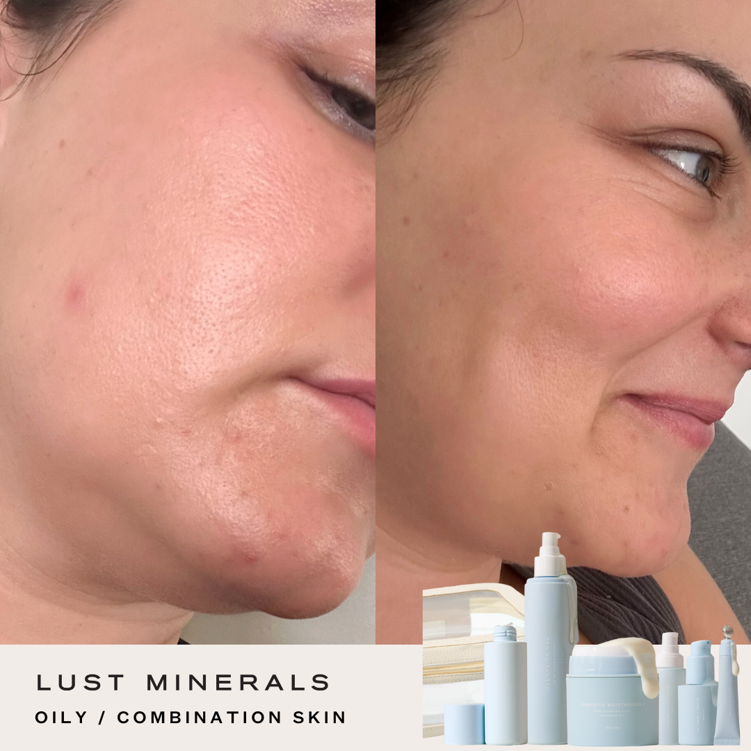 Stacey's Everyday Go-To Skincare System