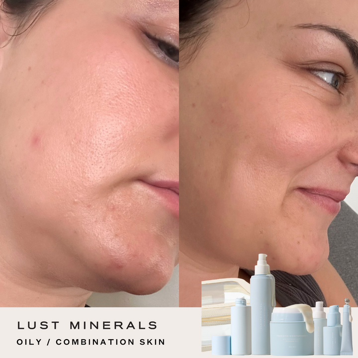Stacey's Everyday Go-To Skincare System