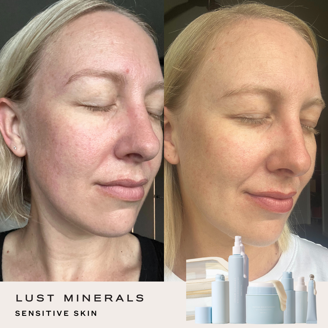 Stacey's Everyday Go-To Skincare System