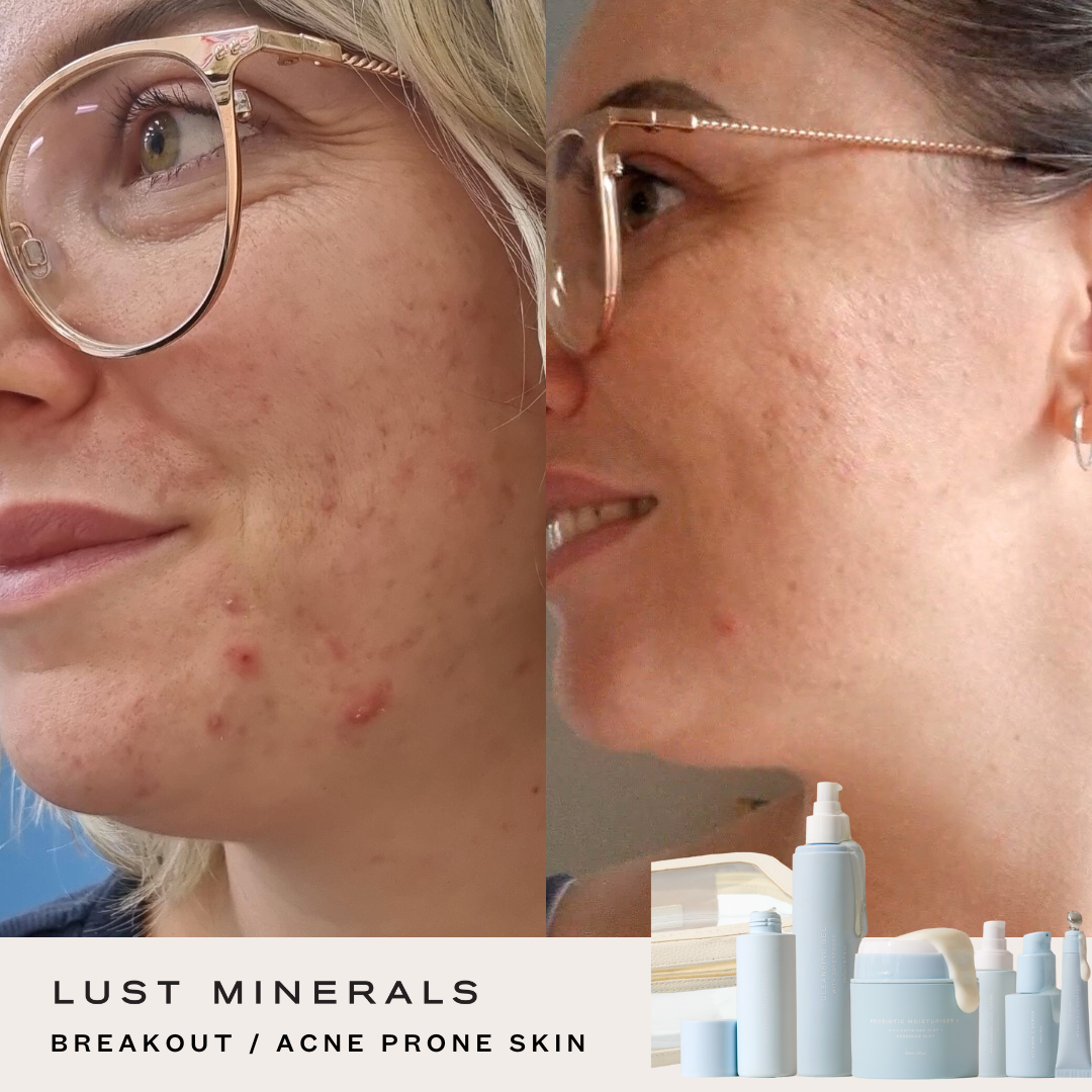 Stacey's Everyday Go-To Skincare System