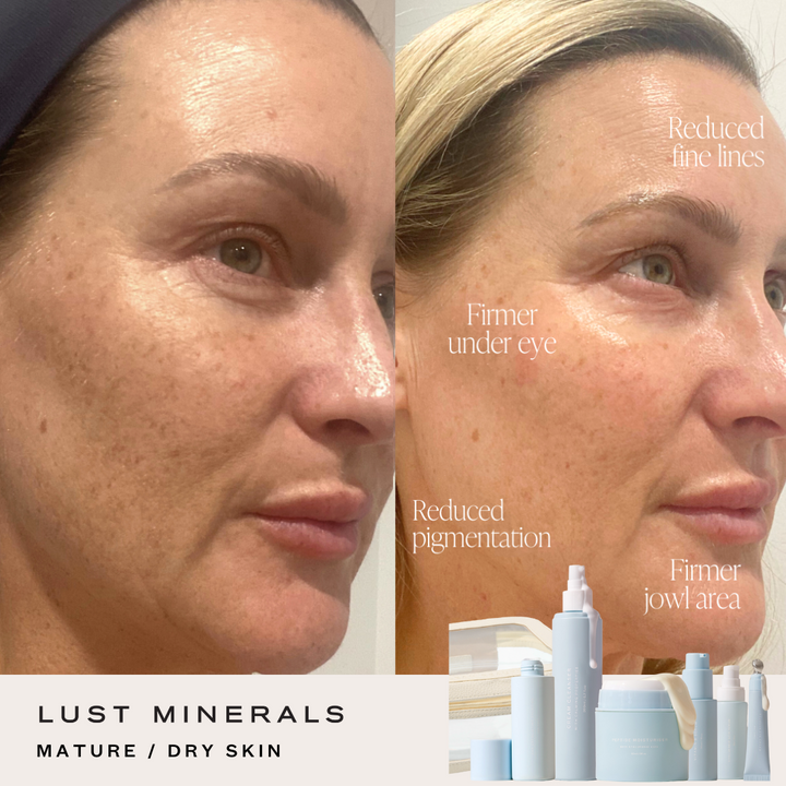 Stacey's Everyday Go-To Skincare System