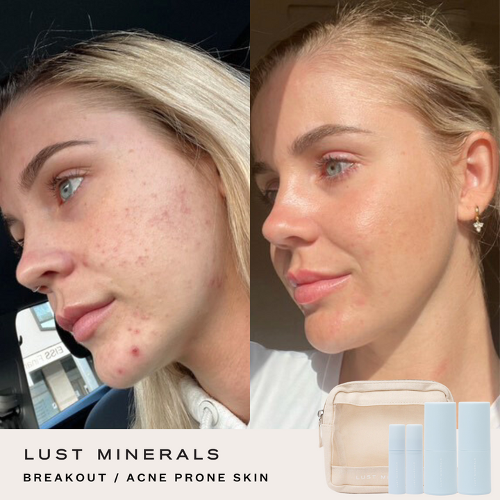 Targeted Skincare Trial System