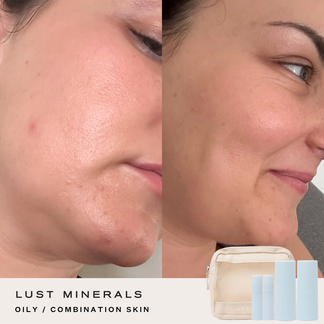 Targeted Skincare Trial System