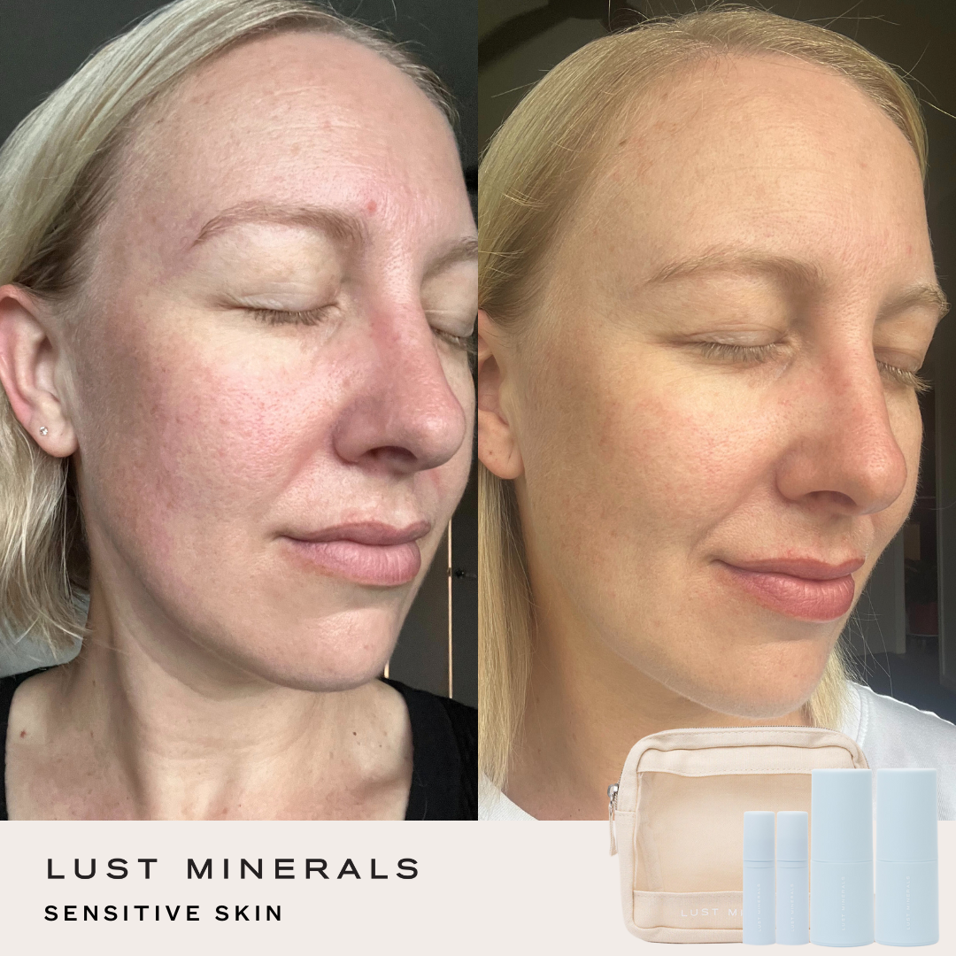Targeted Skincare Trial System