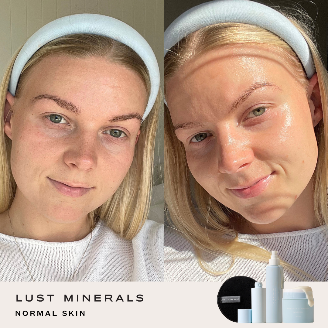 Teen Skincare System