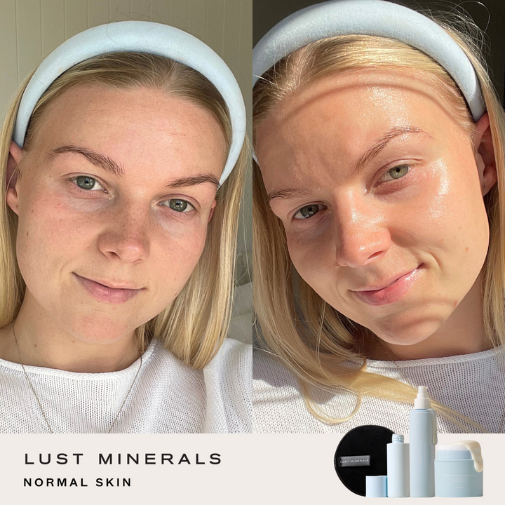Teen Skincare System