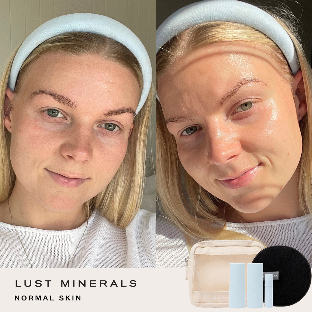 Teen Skincare Trial System