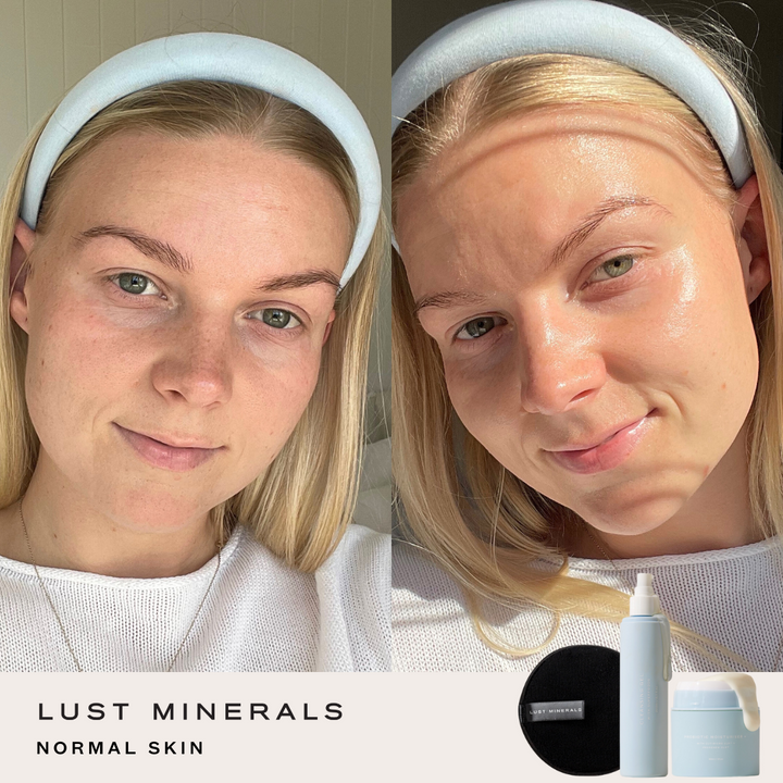 Tween Skincare System
