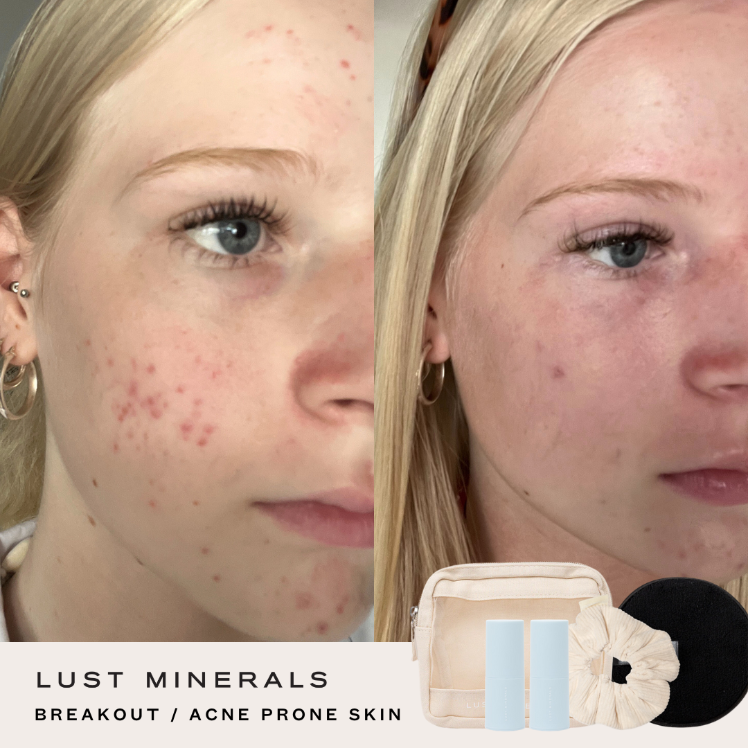 Tween Skincare Trial System