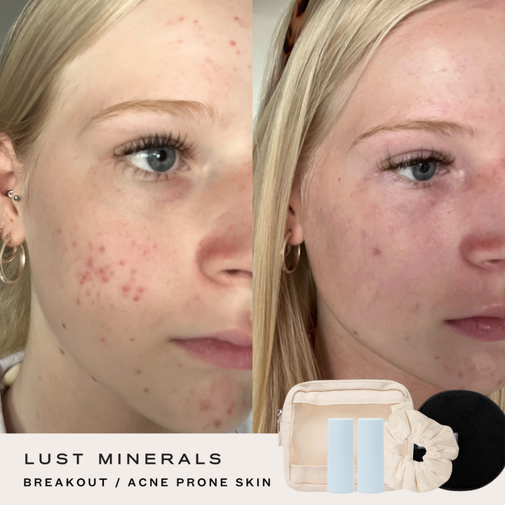 Tween Skincare Trial System