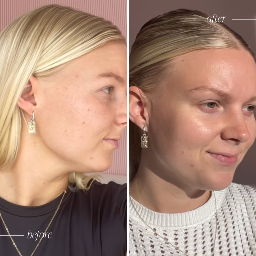 Skin Brightening Sample Bundle