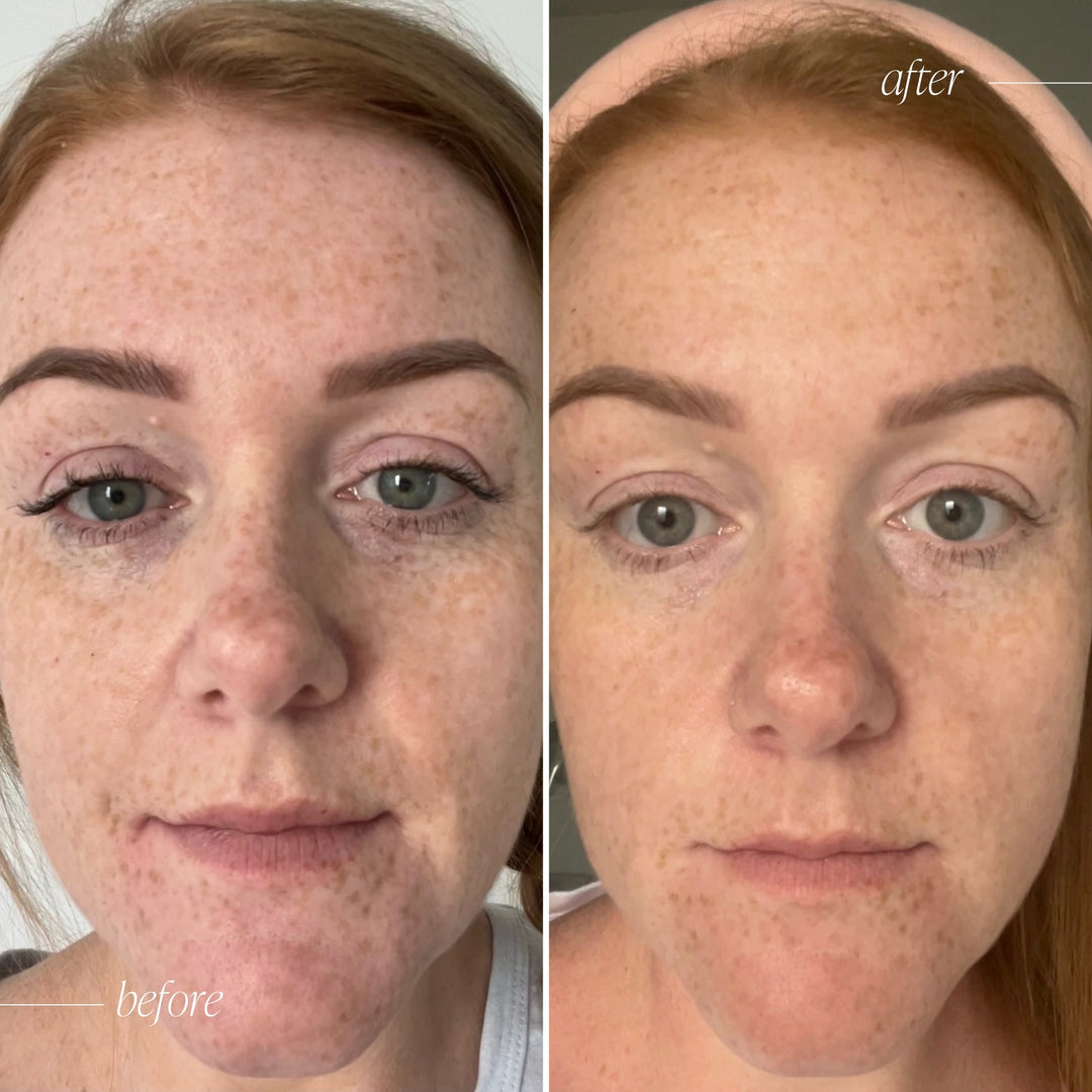 Vitamin C Brightening Serum Complex