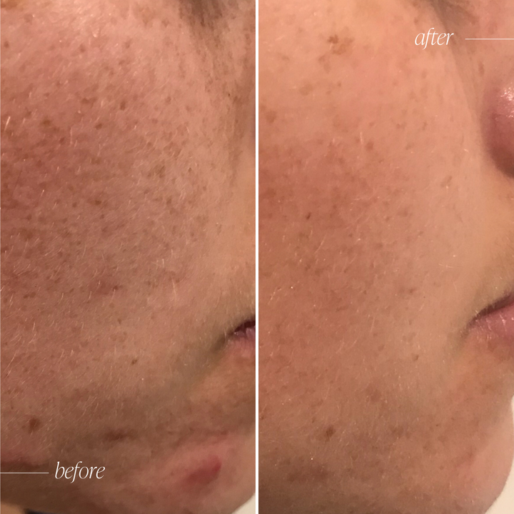 Vitamin C Brightening Serum Complex