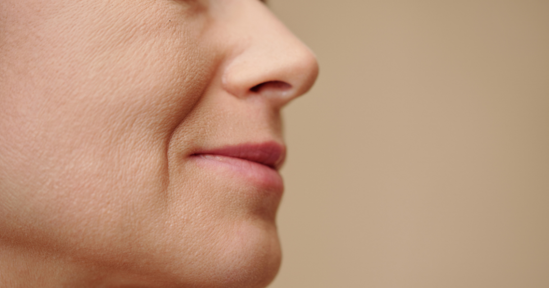 How to Support Laugh Lines Around the Mouth