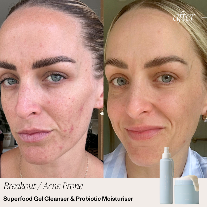 Skin before and after selfie 