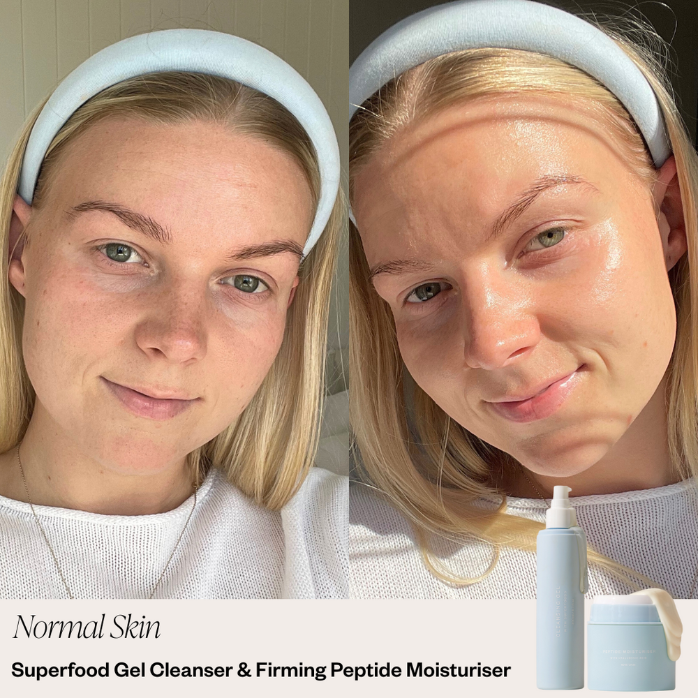 Skin before and after selfie