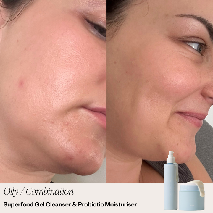 Skin before and after selfie 