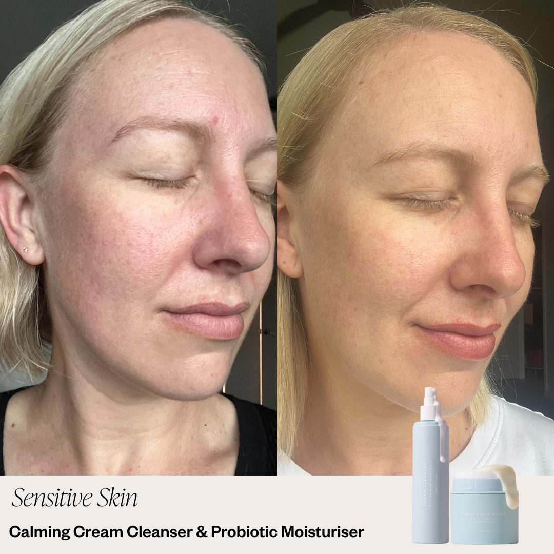 Skin before and after selfie 