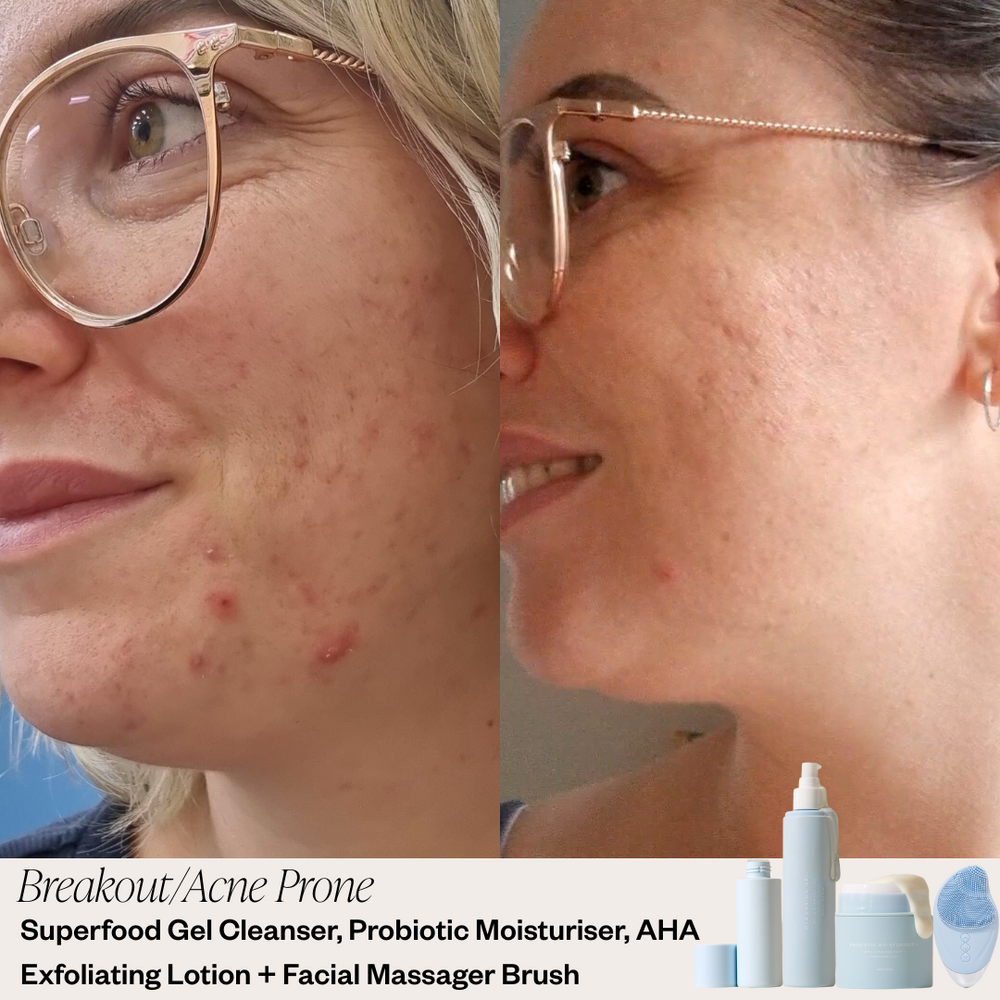 Skin before and after results 