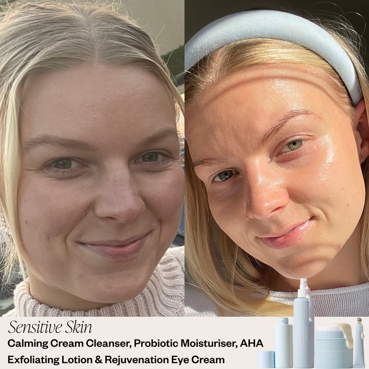 Skin before and after results 