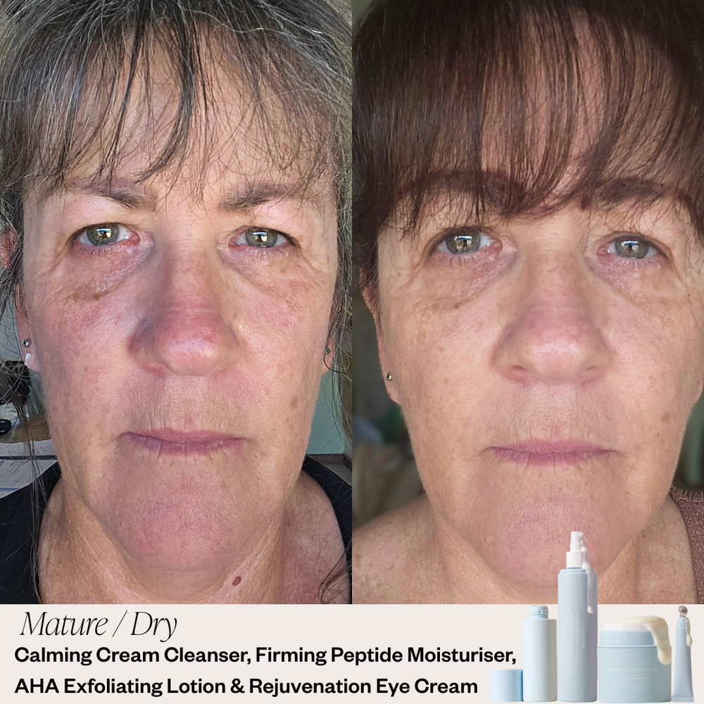 Skin before and after results 