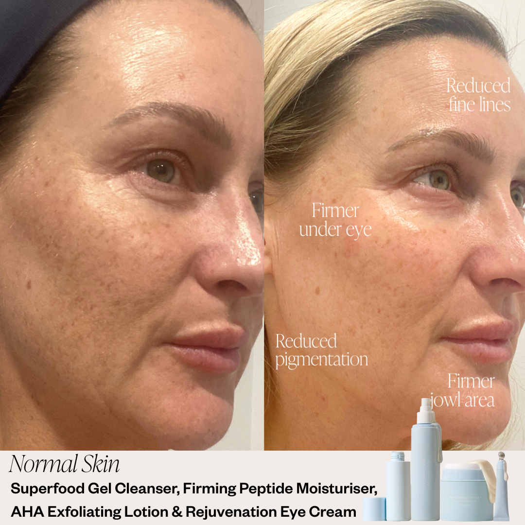 Skin before and after results 