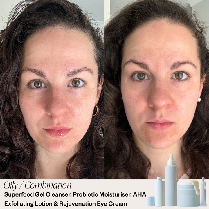 Skin before and after results 