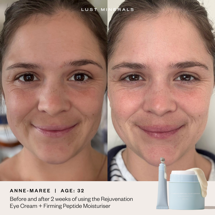 Before and after eye cream results showing reduced puffiness and brighter under-eyes in 28 days