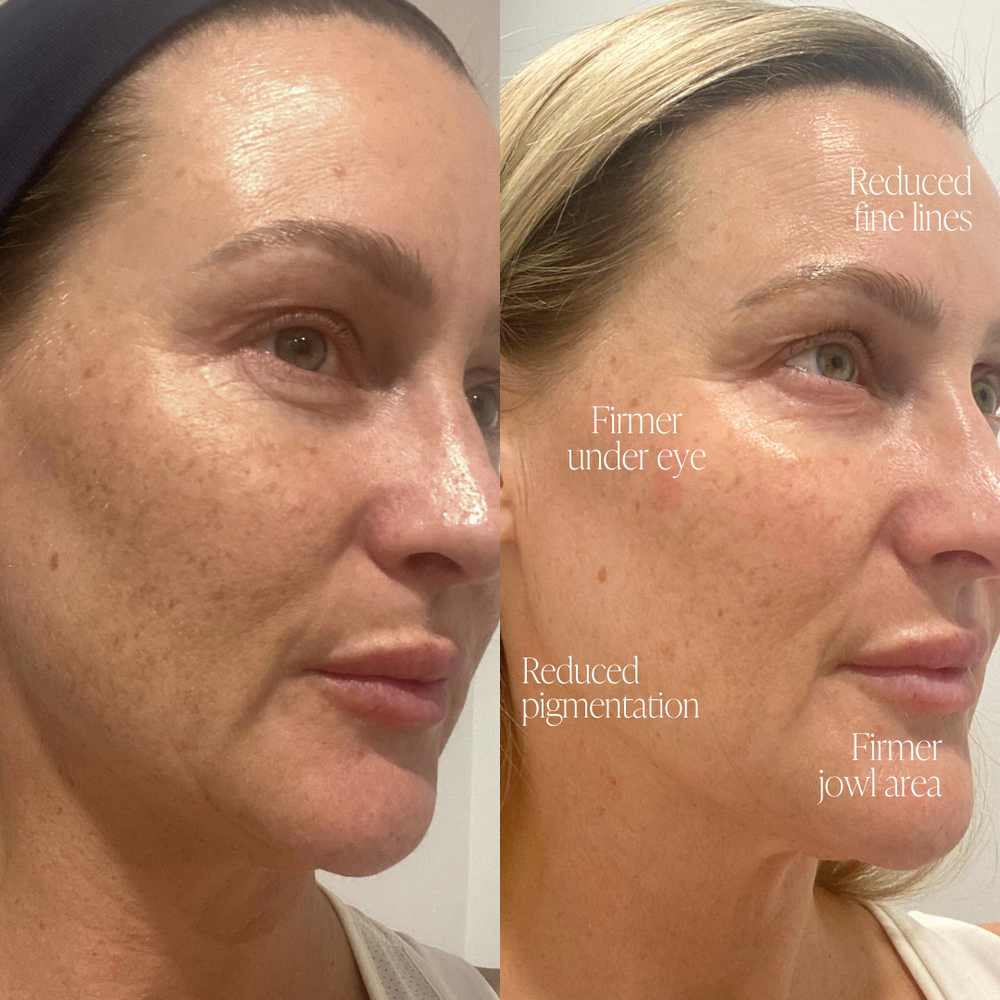 Viral Firming Peptide Moisturiser results in 28 days