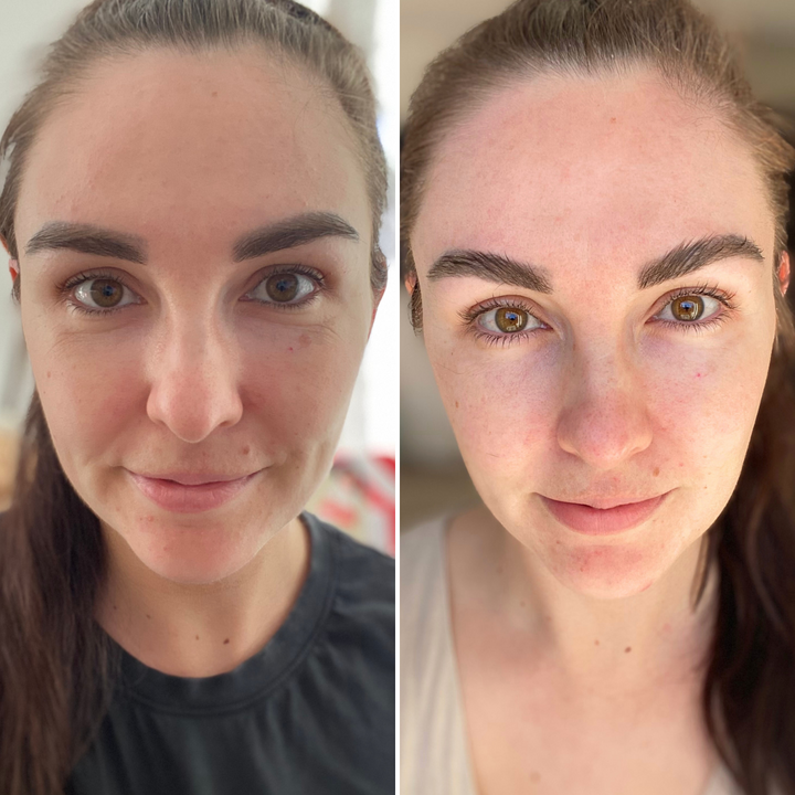 Viral Firming Peptide Moisturiser results in 28 days